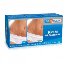 Крем До и после от растяжек 100 мл